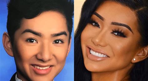 nikita dragun penis|Nikita Draguns Plastic Surgery Journey — Before and。